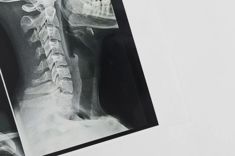 Рентгенография